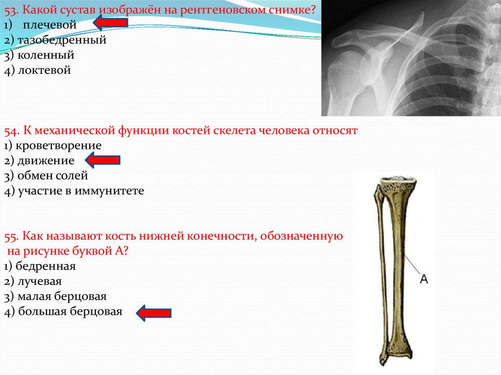 Косте 3. Механическая функция костей скелета. Какой сустав изображен на снимке. Какой сустав изображён на рентгеновских снимках?. Какой сустав изображен на рентгеновском снимке коленный.