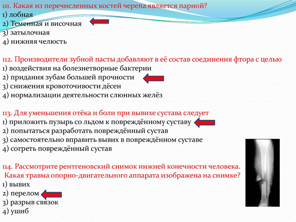 Парной костью является. Какая из перечисленных костей черепа является парной. Какая кость черепа является парной. Какая из перечисленных костей является парнрй. Какие кости являются парными.