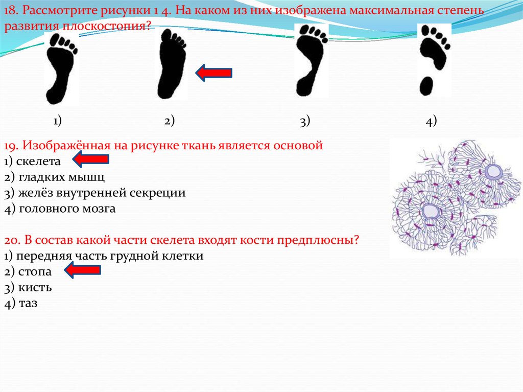 1 undefined. Изображенная на рисунке ткань является основой скелета гладких мышц. Изображённая на рисунке ткань является основой. Изображённая на рисунке ткань является основой 1 скелета. Изображённая на рисунке ткань является основой головного мозга.