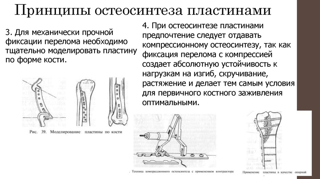 Внеочаговый остеосинтез презентация