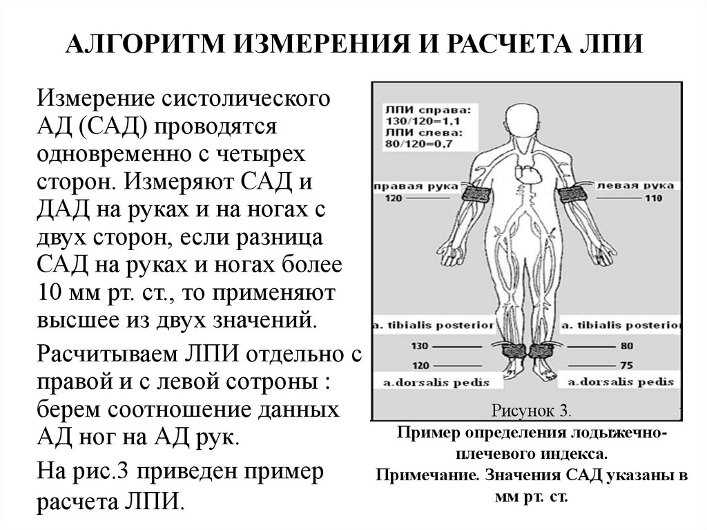 Лазер лпи 120 схема