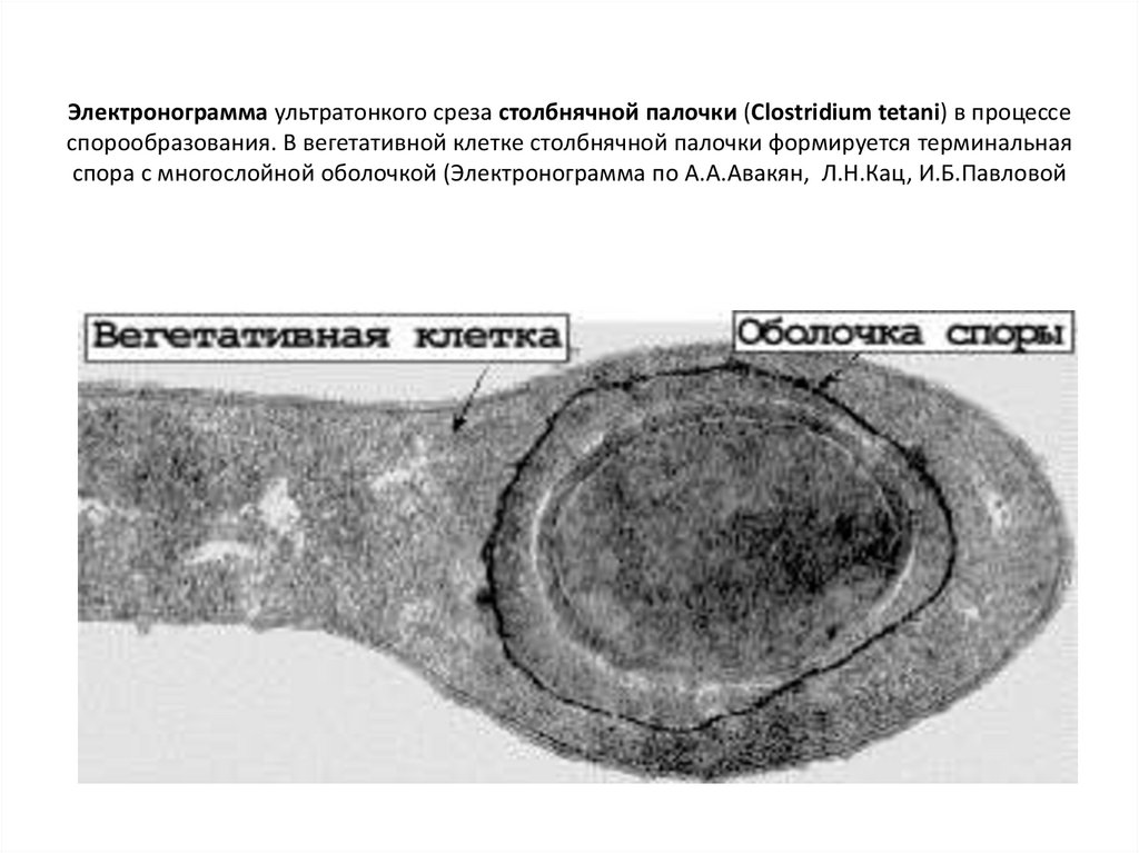 Электронограмма ультратонкого среза столбнячной палочки (Clostridium tetani) в процессе спорообразования. В вегетативной