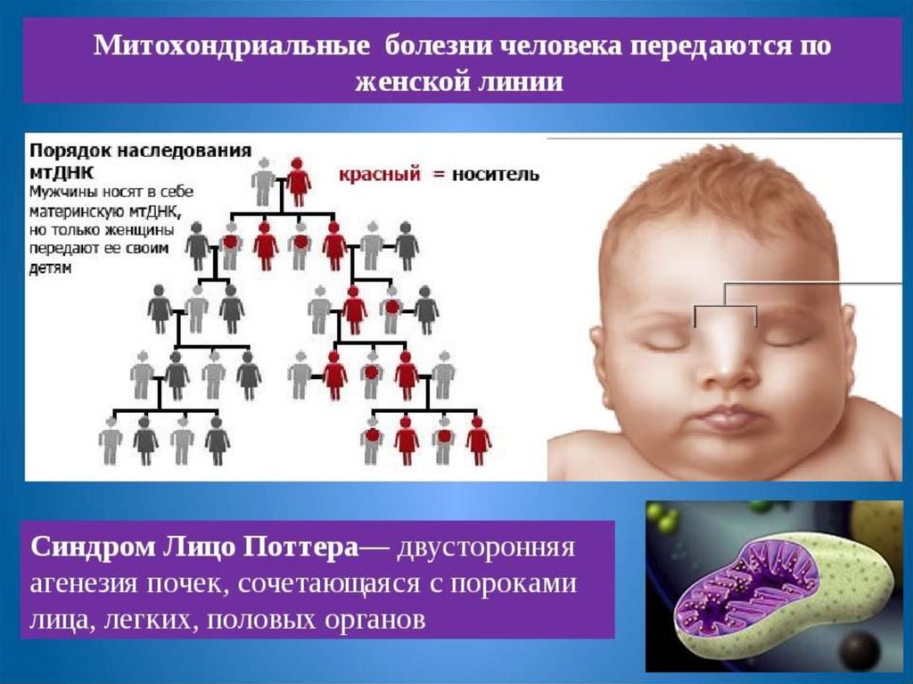 Наследственные аномалии. Митохондриальные болезни. Наследуемые болезни человека. Генетические наследственные болезни. Митохондриальные заболевания у детей.