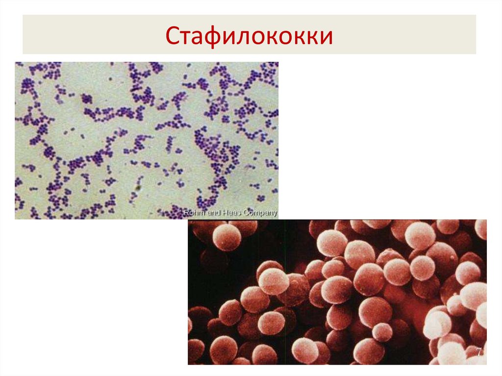Staphylococcus aureus 5. S. aureus золотистый стафилококк. Стафилококки и стрептококки микробиология. Стафилококки микробиология морфология. Стрептококк ауреус.