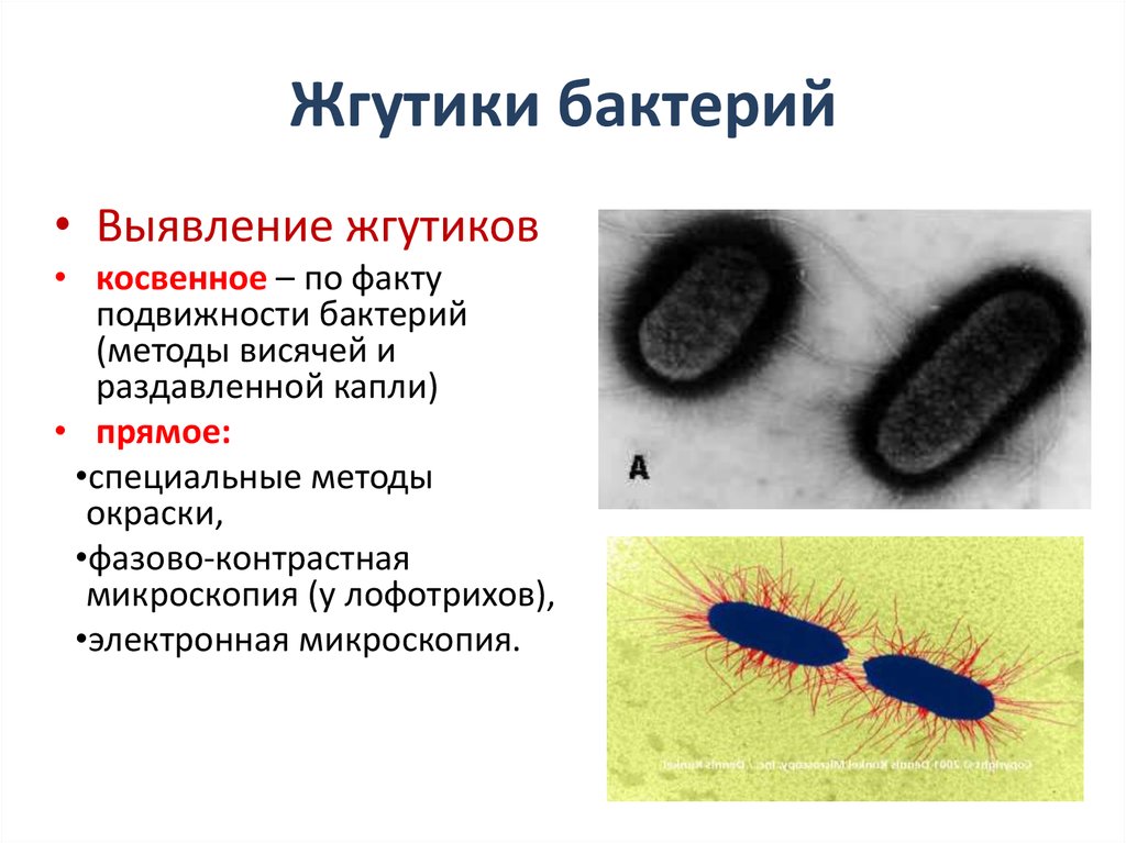 Лофотрихи. Метод обнаружения жгутиков у бактерий. Строение жгутиков бактерий микробиология. Строение жгутика бактериальной клетки. Метод косвенного выявления жгутиков у бактерий.