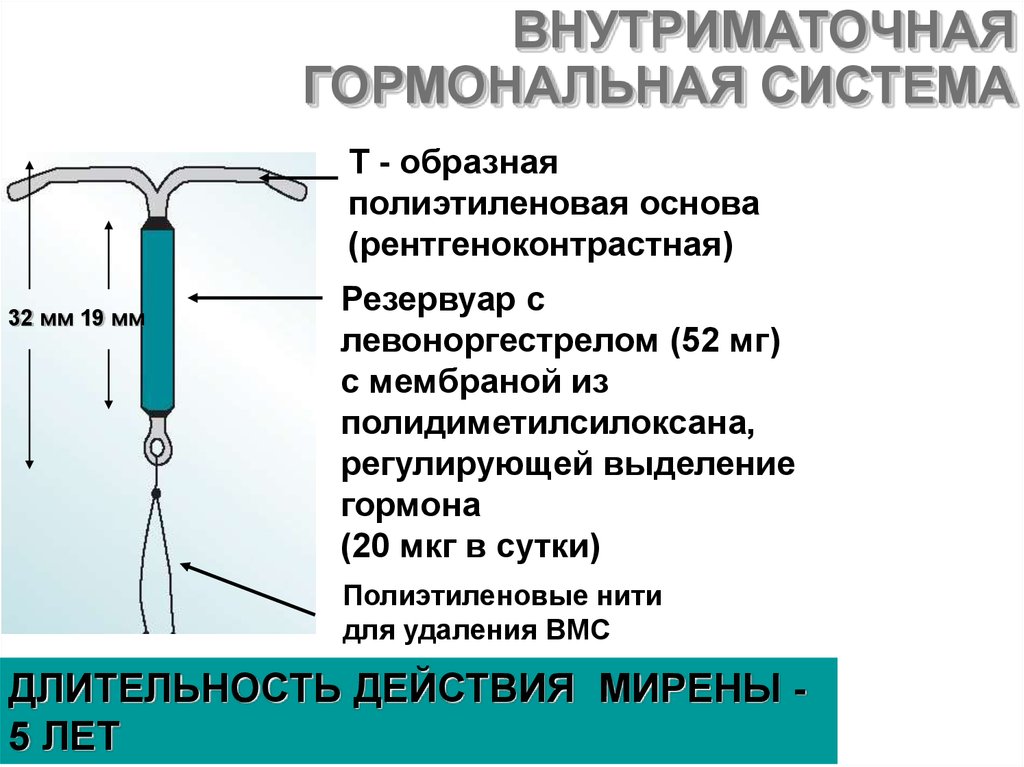 Удаление спирали. Механизм действия ВМС. Кольцо внутриматочное инструкция. Внутриматочные орошения.