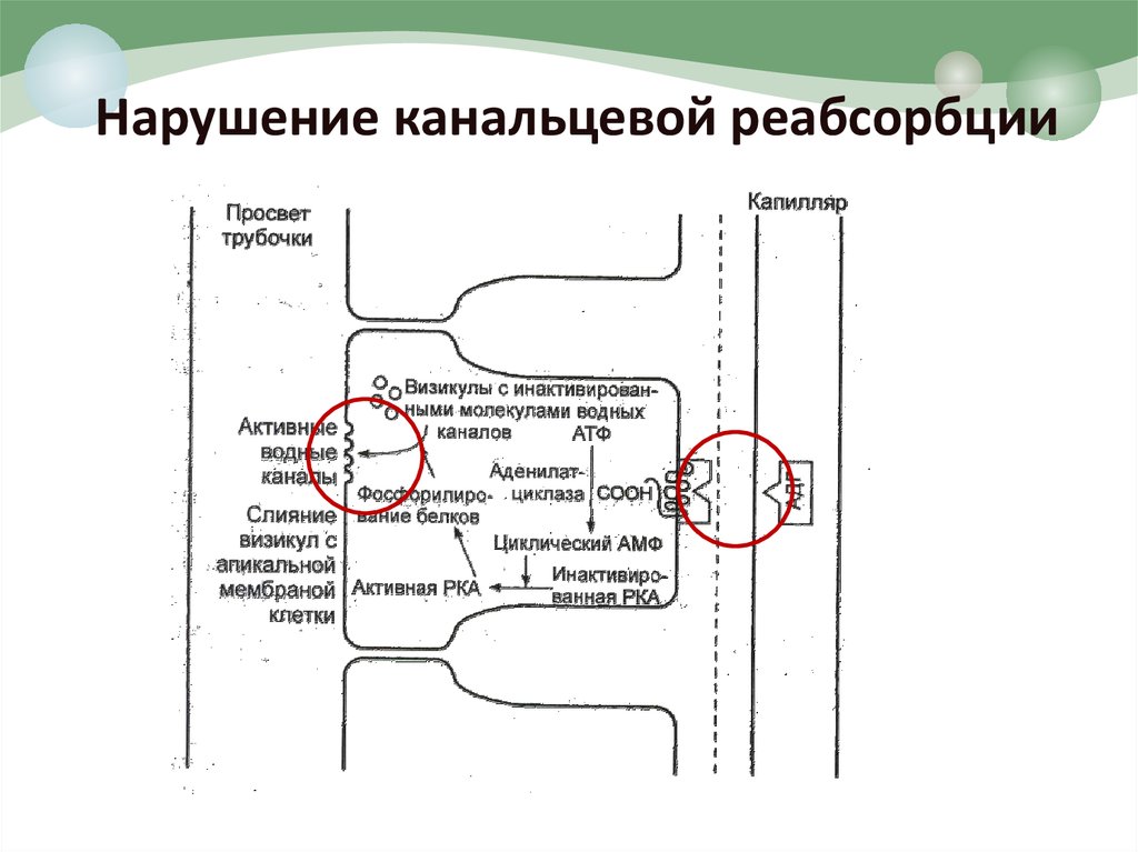 Нарушение реабсорбции почек. Механизмы нарушения канальцевой реабсорбции и секреции. Причины и механизмы нарушений канальцевой реабсорбции. Причины нарушения канальцевой реабсорбции. Нарушение канальцев реабсорбции.