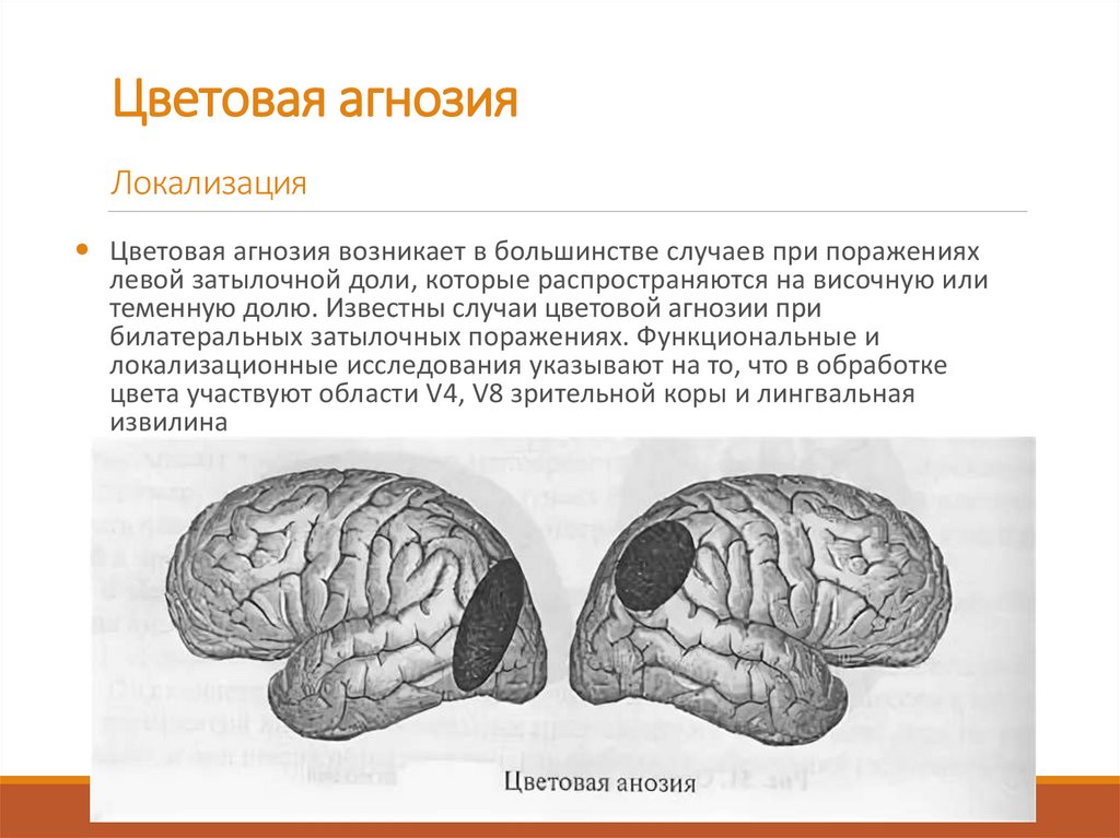 Локализация цветового гнозиса. Зрительный Гнозис. Картинки для зрительного гнозиса. Доли коры головного мозга и их функции.