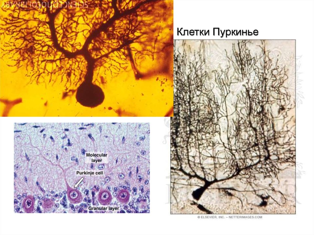Клетки пуркинье рисунок
