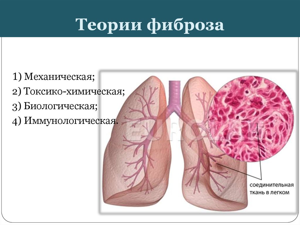 Умеренные фиброзные изменения. Метатуберкулезный пневмосклероз. Пневмосклероз легочной ткани. Диффузный пульмосклероз.