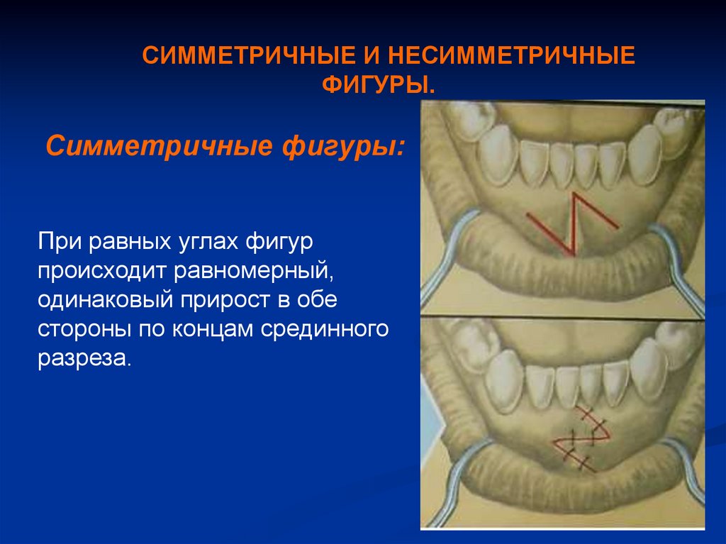 Презентация пластика местными тканями