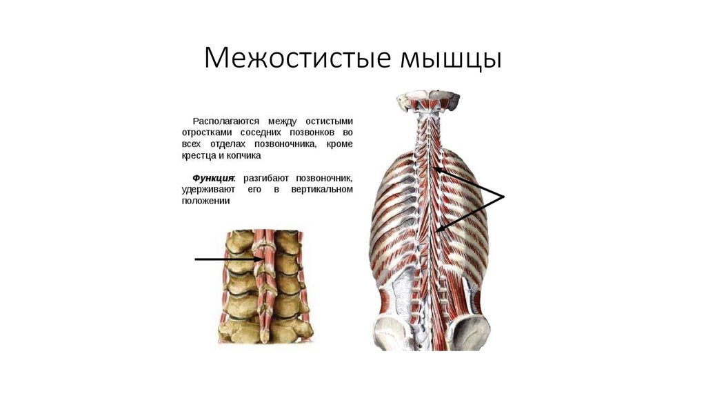 Межостистые мышцы