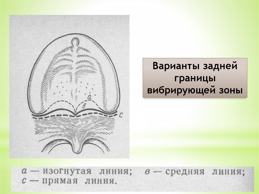 Протезное ложе. Вибрирующая зона. Линия а в протезном ложе. Линия «а» (вибрирующая зона «а»). Границы протезного ложа.