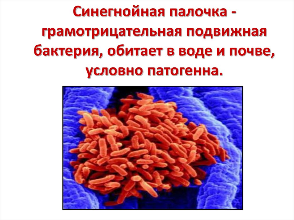 Бактерия синегнойная палочка. Факторы патогенности синегнойной палочки микробиология. Факторы патогенности синегнойной палочки. Синегнойная палочка факторы патогенности.
