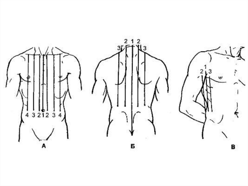 Вертикальные линии соединяющие. Клиническая топография грудной клетки. Топографические линии грудной клетки. Топография линии грудной клетки. Условные вертикальные линии грудной клетки.