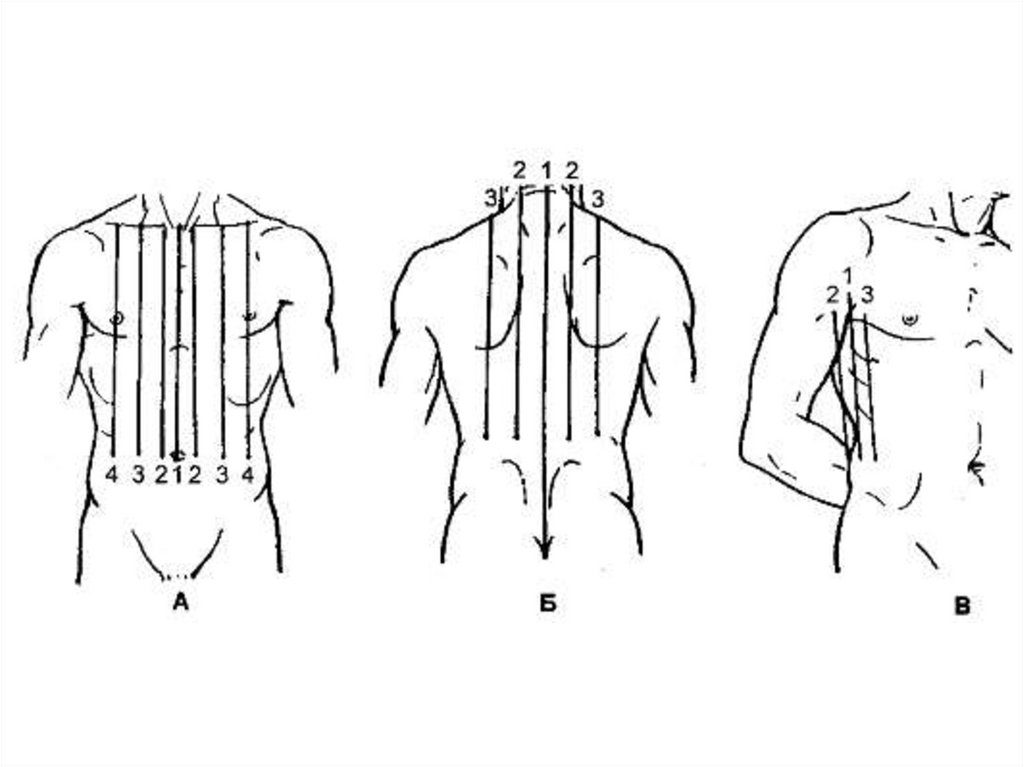 Линии туловища. Топографические линии грудной клетки. Топография линии грудной клетки. Топографические линии грудной клетки схема. Клиническая топография грудной клетки пропедевтика.