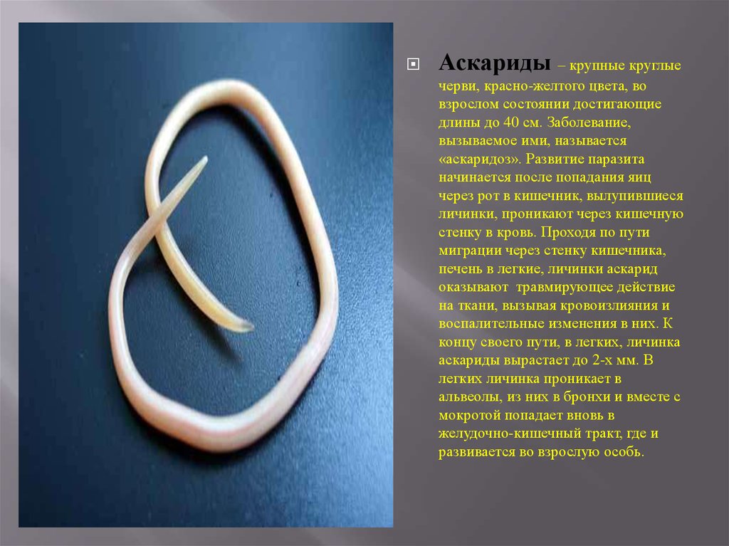 Почему круглых червей. Черви аскарида аскарида. Паразитические черви аскариды. Аскаридоз (круглые черви до 40 см. Круглые черви аскарида человеческая.