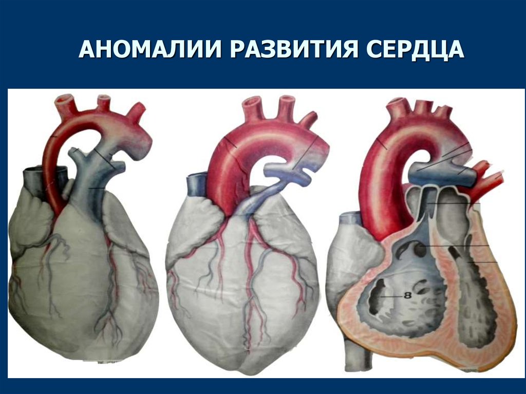 Аномалии развития