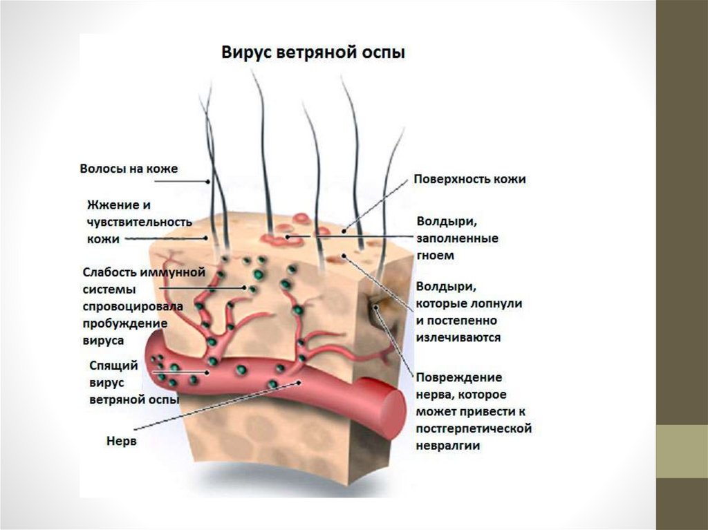 Как выглядит оспа фото