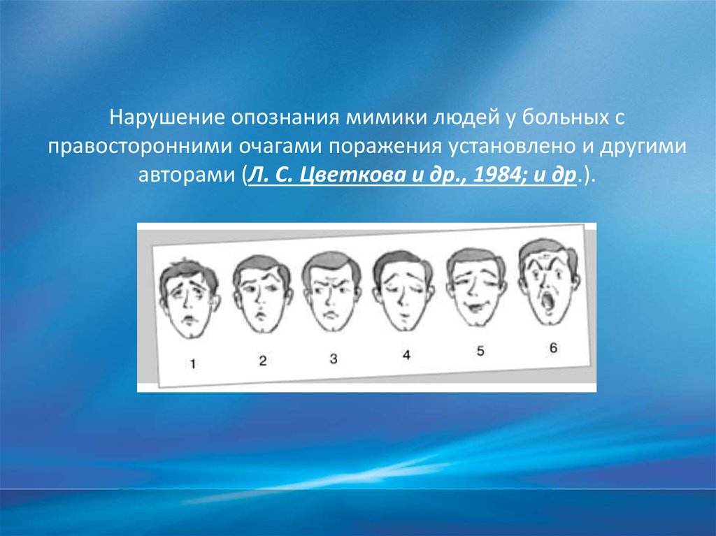 Нарушении опознания реальных лиц и их изображений являются признаками нарушений