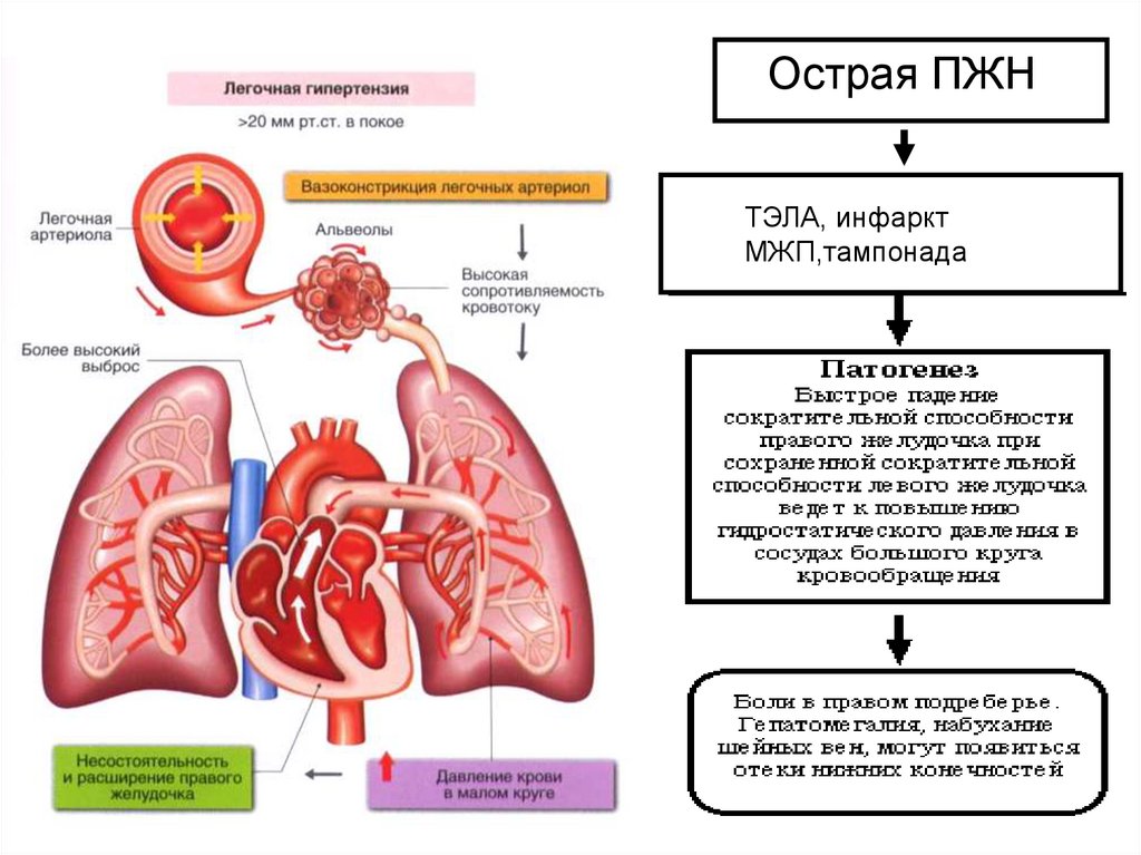 Сердечно легочная недостаточность презентация