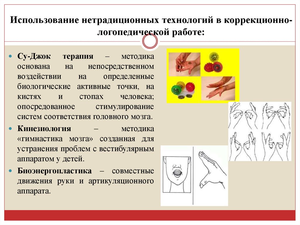 Презентация к защите диплома по логопедии