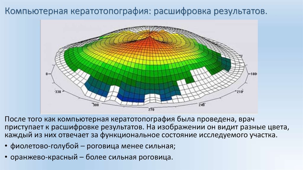 Компьютерная кератотопография что это