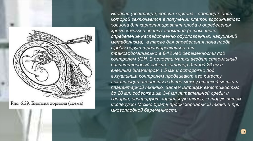 Ткань плода. Аспирация ворсин хориона. Биопсия Ворстн хор она. Аспирация/биопсия ворсин хориона.