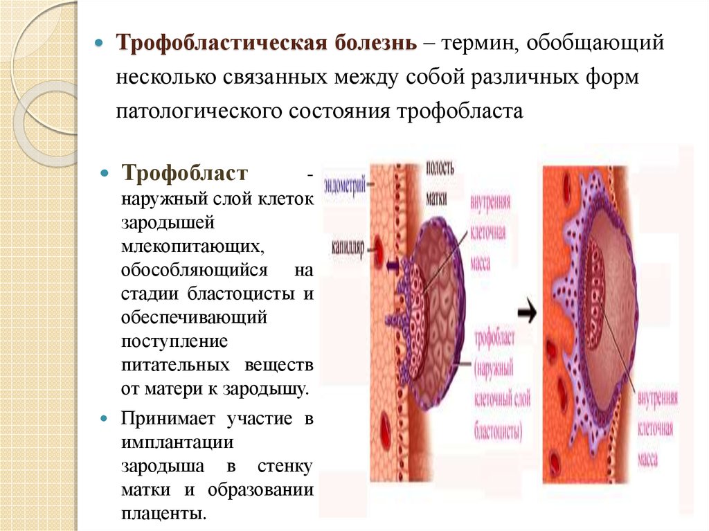 Трофобластическая болезнь гинекология презентация