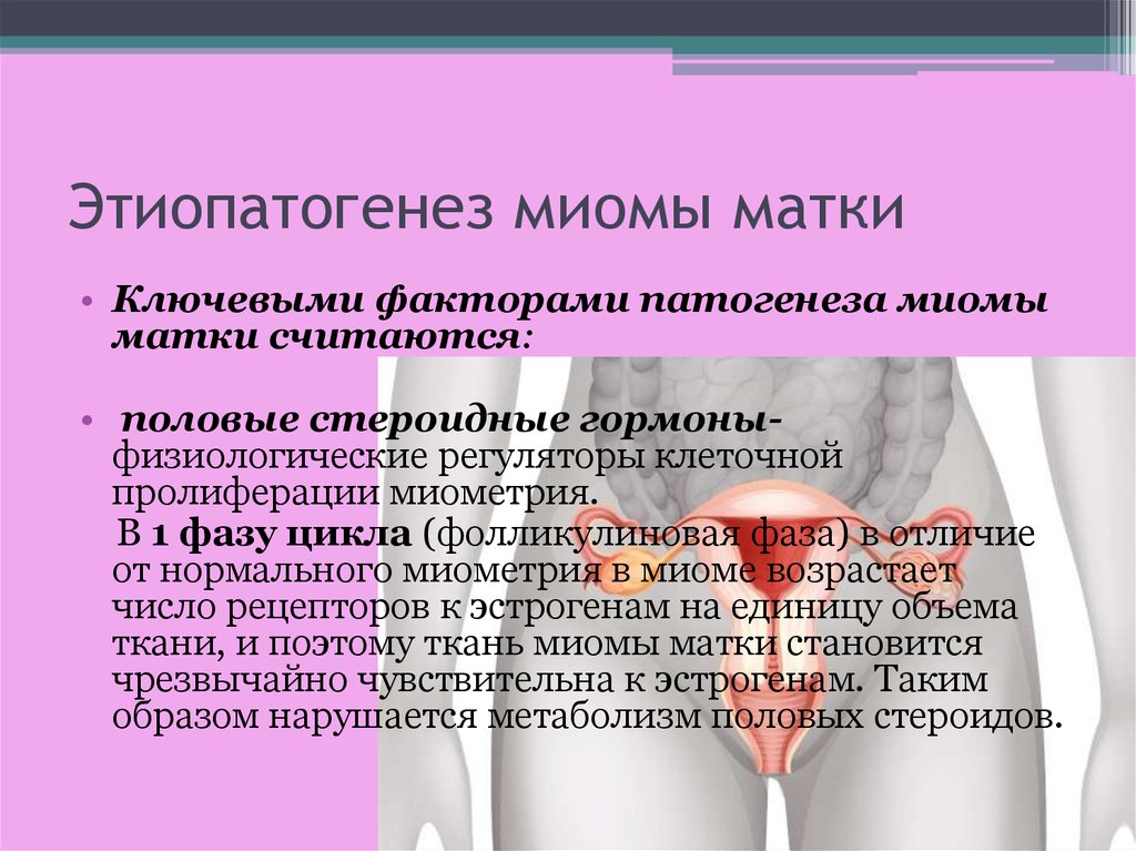 Эстрогены миома. Этиопатогенез миомы матки. Миома матки этиология. Миома матки этиология и патогенез.