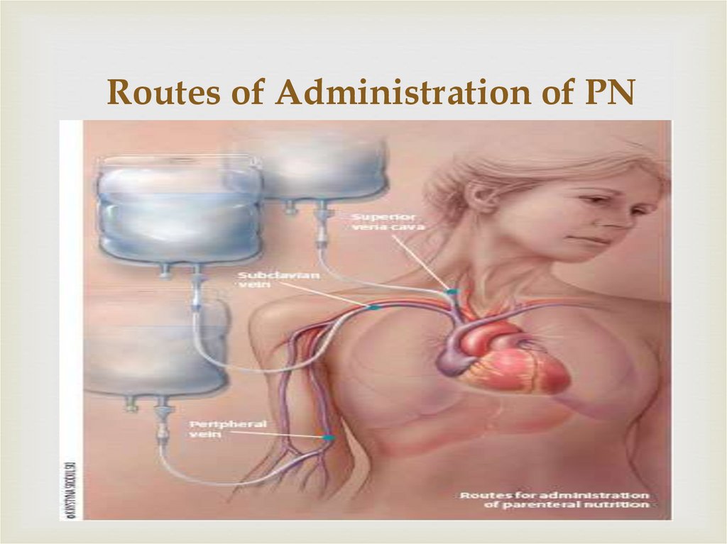 Routes of Administration of PN
