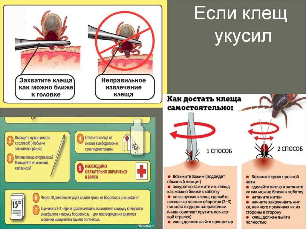 Как избавиться от клеща. Ккаккк выдавитььь кклещща. Как правильно вытащить клеща. Как правильно извлечь клеща.