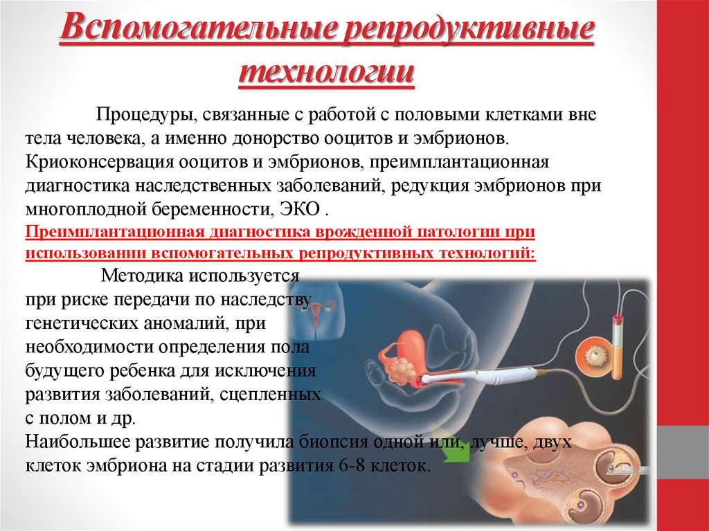 Подсадка эмбриона суррогатной матери. Вспомогательные репродуктивные технологии. Методы вспомогательных репродуктивных технологий. Вспомогательные репродуктивные технологии (ВРТ). Эко экстракорпоральное оплодотворение.