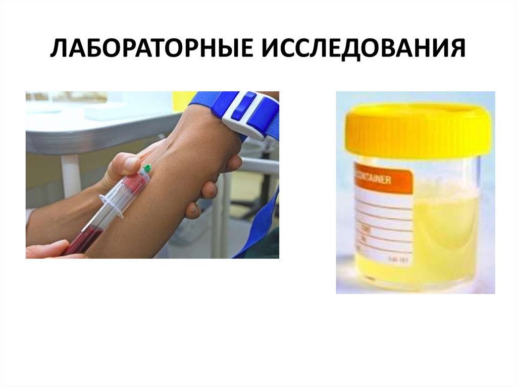 ЛАБОРАТОРНЫЕ ИССЛЕДОВАНИЯ