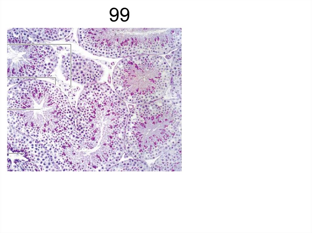 99