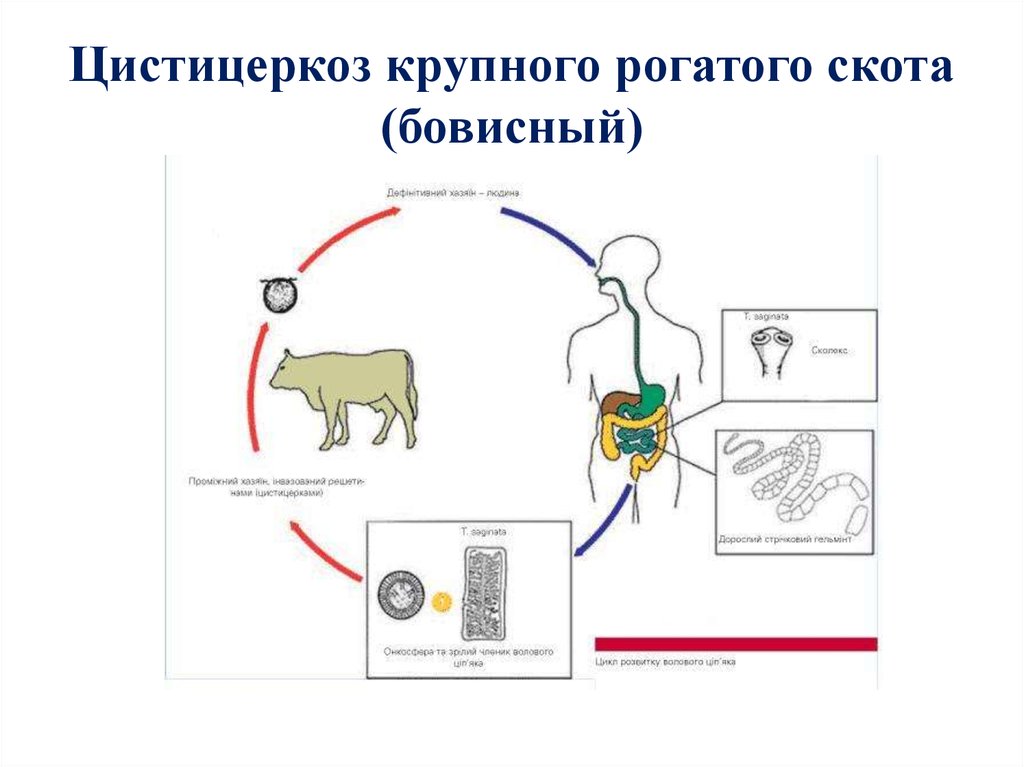 Свиной цепень диагностика