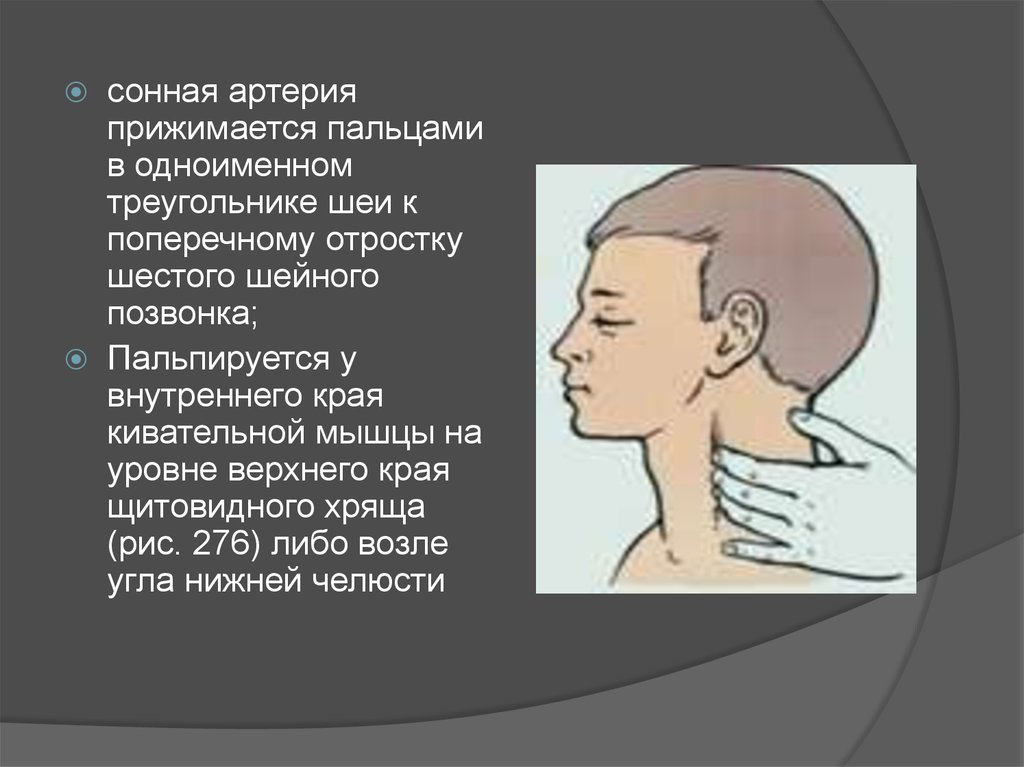 Сонные артерии на шее человека фото