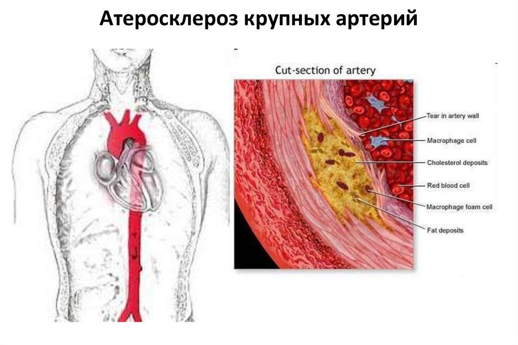 Патофизиология сосудистого тонуса презентация