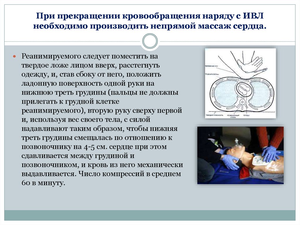 С какой частотой производится непрямой массаж сердца