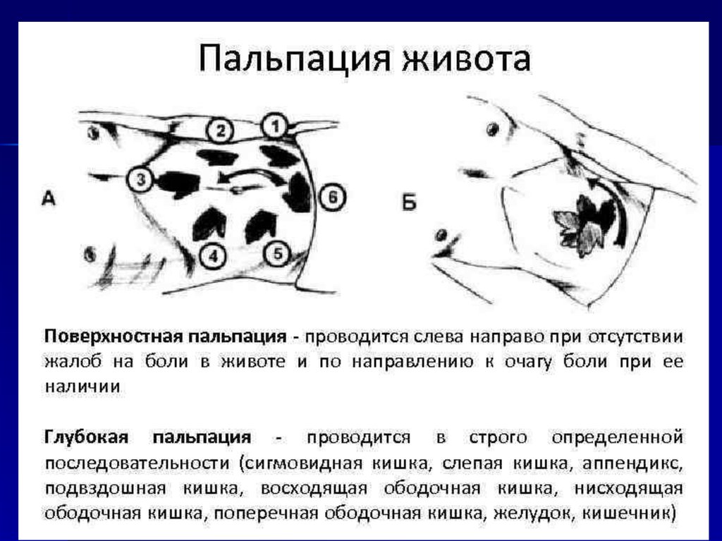 Пальпация живота. Методика поверхностной пальпации живота. Поверхностная пальпация живота алгоритм пропедевтика. Точки поверхностной пальпации живота. Техника поверхностной пальпации живота алгоритм.