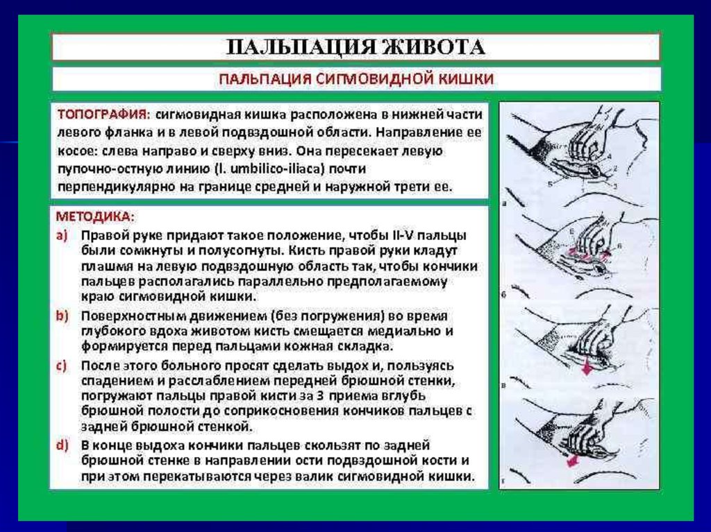 Схема глубокой пальпации живота