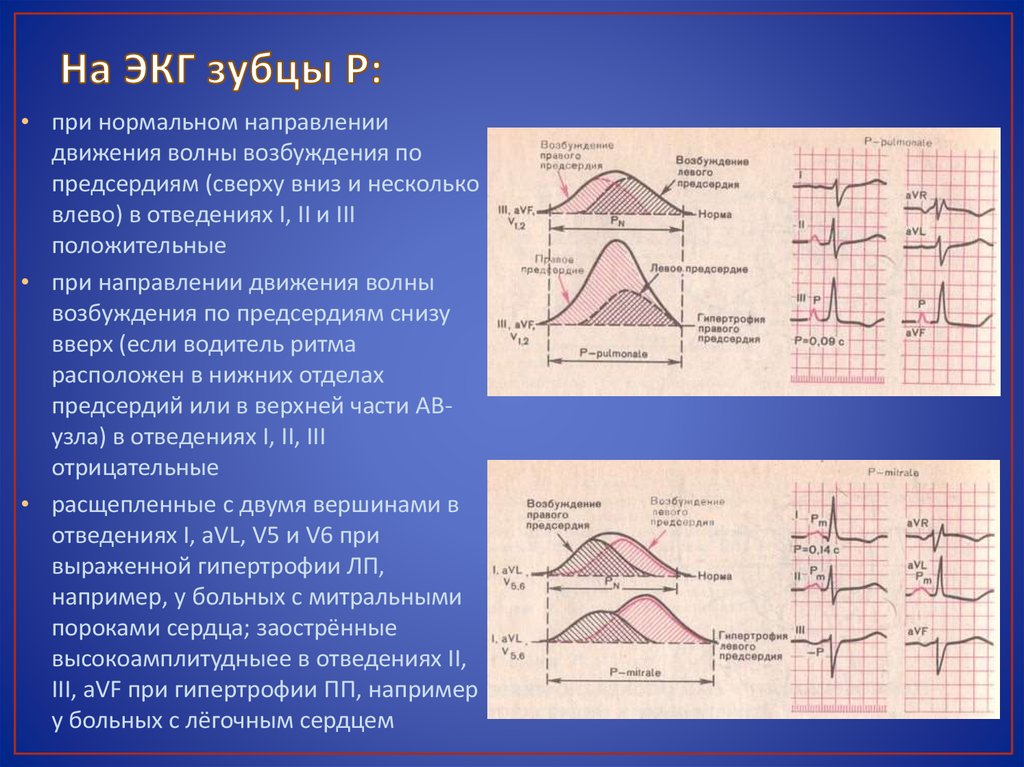 Расшифровка экг таблица