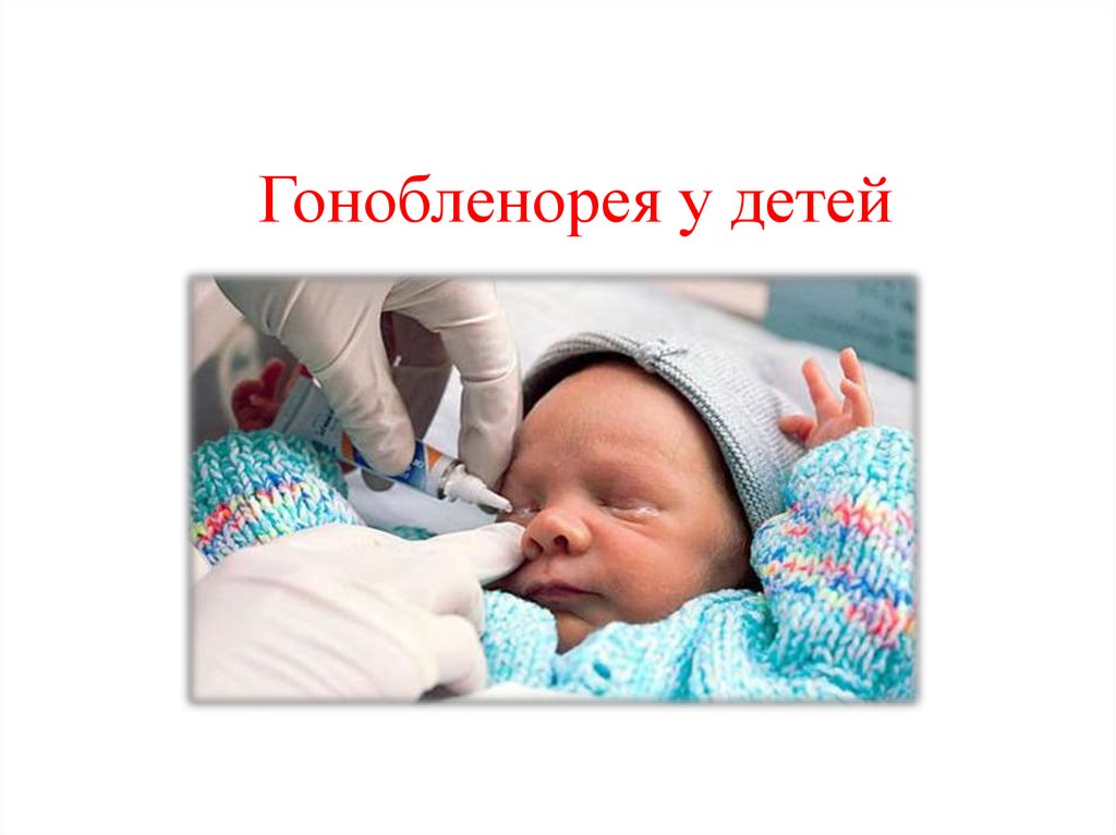 Гонобленорея у детей - презентация онлайн