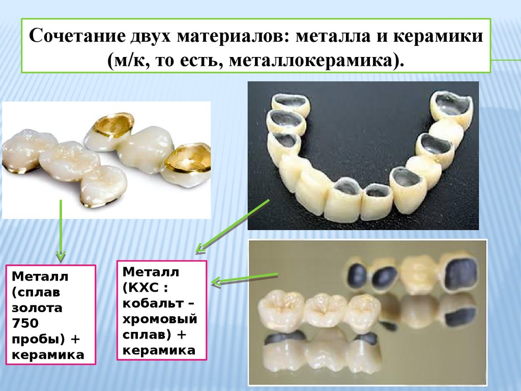 Презентация керамика в стоматологии