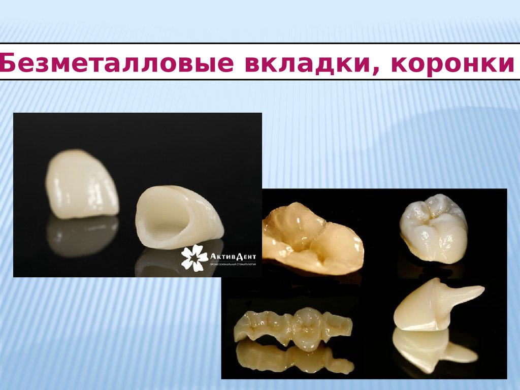 Презентация безметалловая керамика