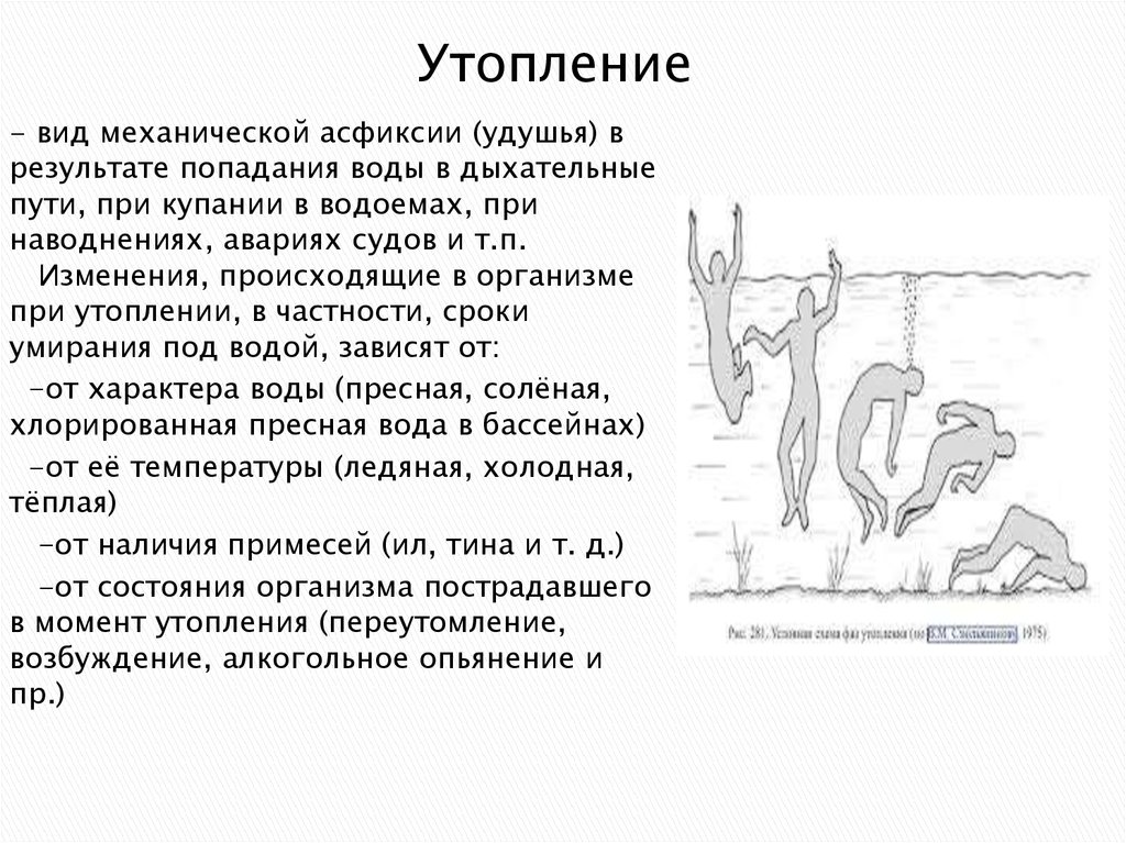 Утопление это. Асфиксия при утоплении в воде. Механическая асфиксия утопление. Что такое механическая асфиксия при утоплении в воде. Механическая асфиксия при утоплении.