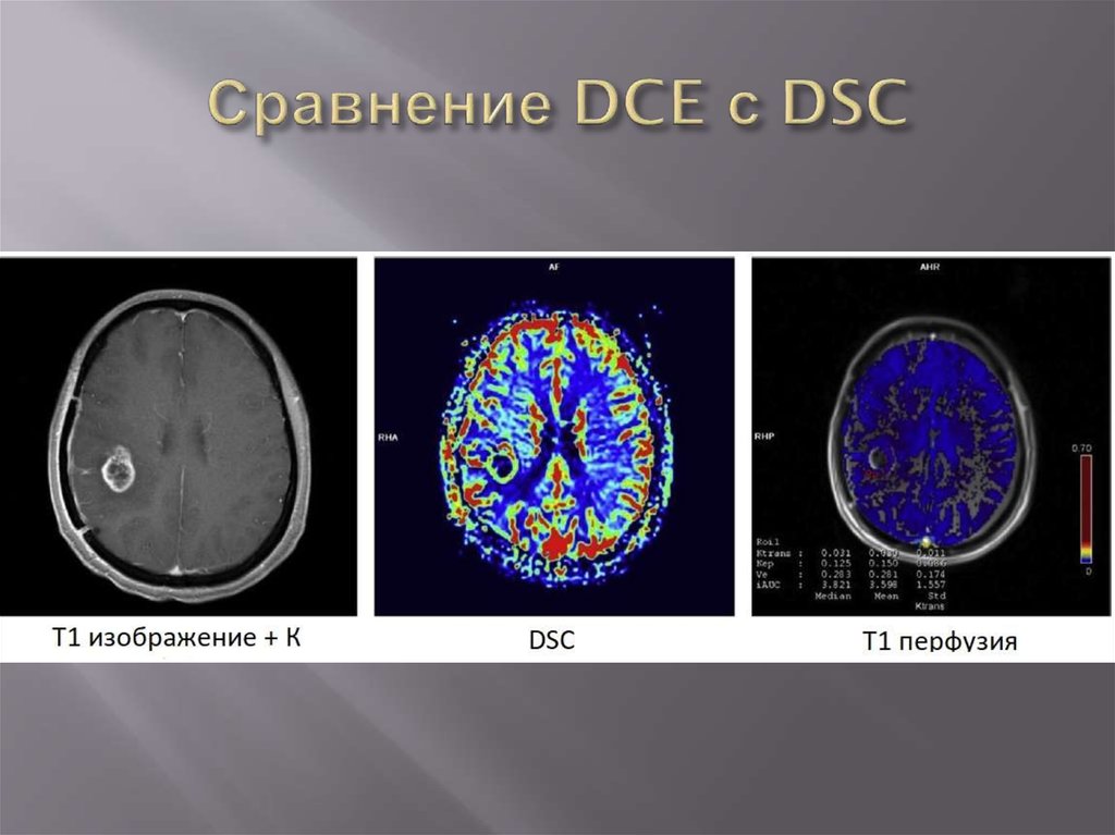 Сравнение DCE с DSC