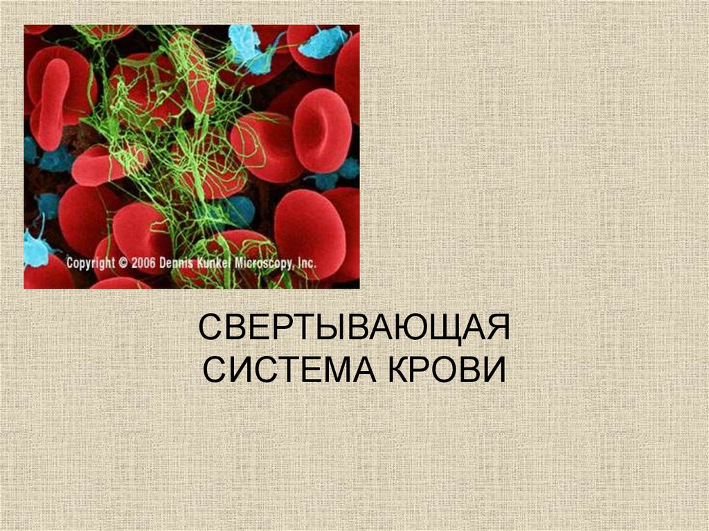 Свертывающая и противосвертывающая система крови презентация