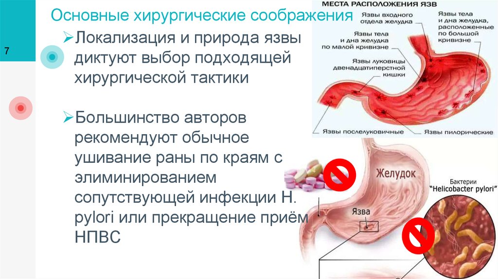 Прободная язва желудка карта вызова скорой