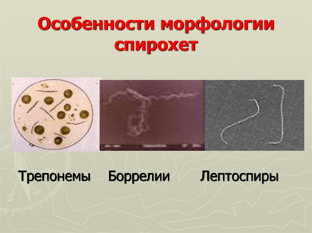 Спирохеты. Морфология спирохет. Особенности морфологии спирохет. Классификация и морфология спирохет. 2. Особенности морфологии и строения семейства спирохет..